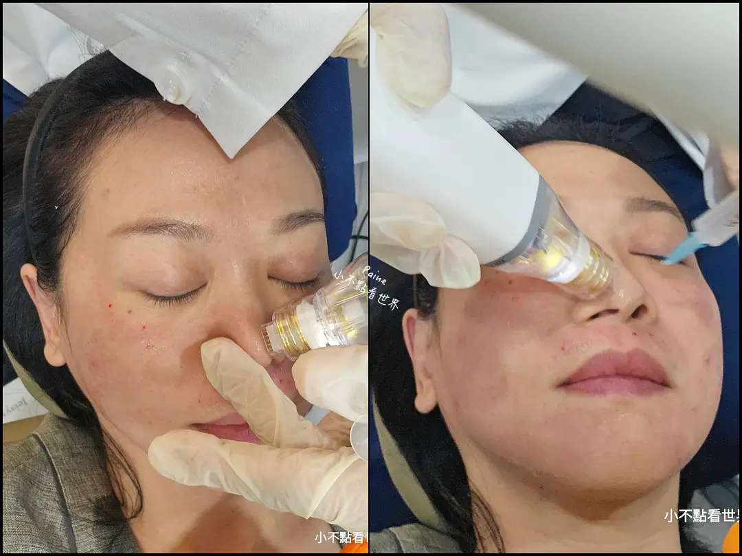 江南奧恩醫美診所